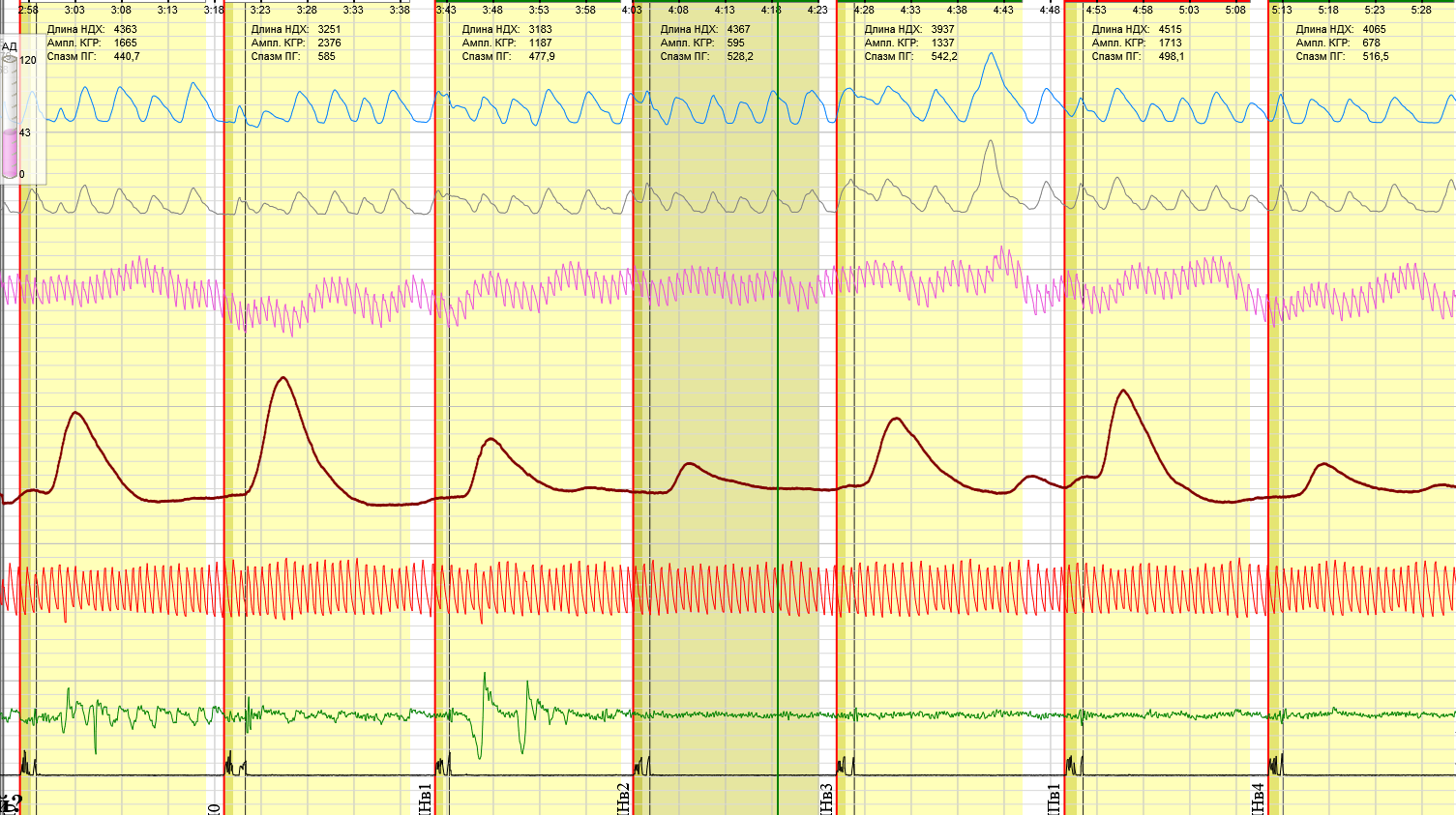 САТ на имя 1